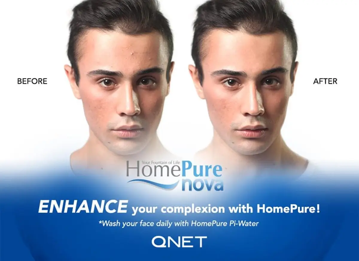 QNET